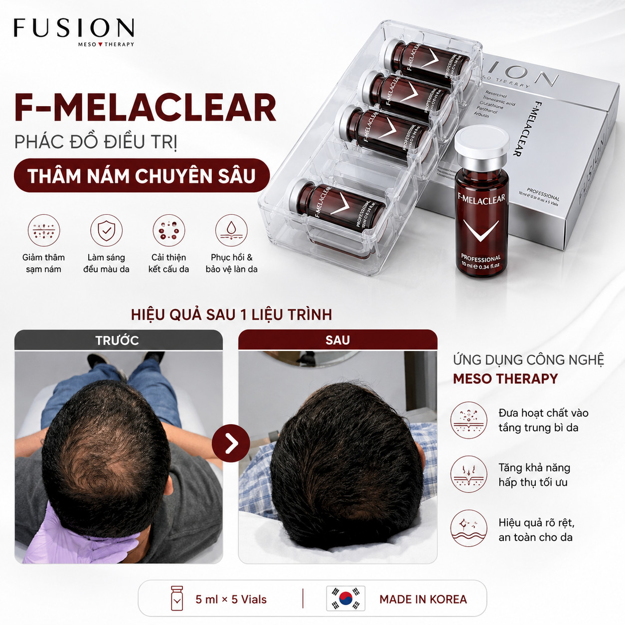 F-Hair Men4