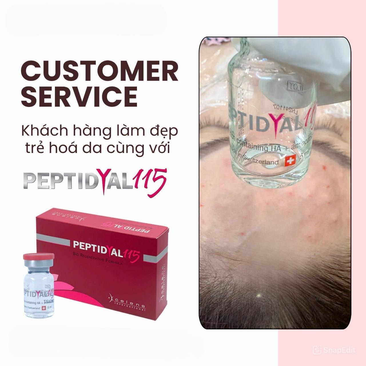 Peptidyal 115 – Meso cocktailfdewf